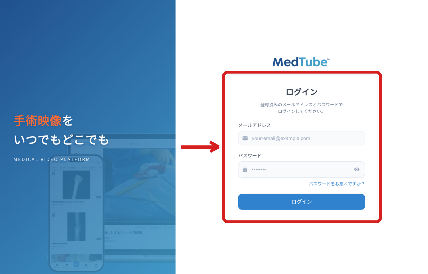 MedTube のログイン画面の全体。左側に「手術映像を いつでもどこでも MEDICAL VIDEO PLATFORM」のビジュアルがあり、右側の「ログイン」カード全体が赤い枠で囲まれ、左から赤い矢印が指している。